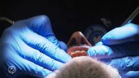 Oproep aan kabinet: tandarts snel terug in basispakket